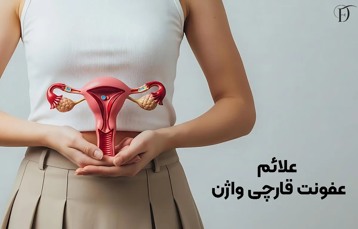 علائم عفونت قارچی واژن