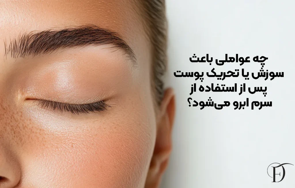 چه عواملی باعث سوزش یا تحریک پوست پس از استفاده از سرم ابرو می‌شود؟