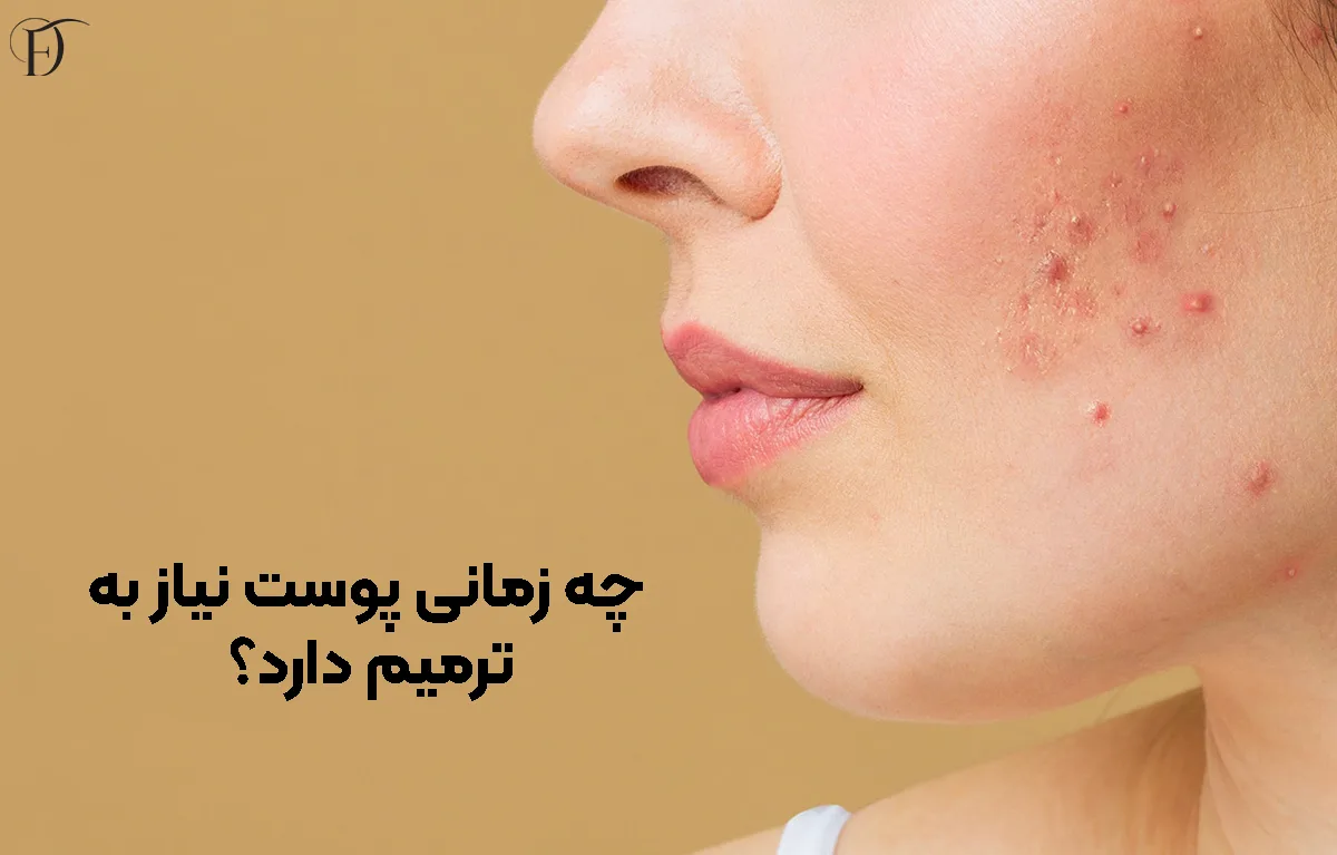 چه زمانی پوست نیاز به ترمیم دارد؟
