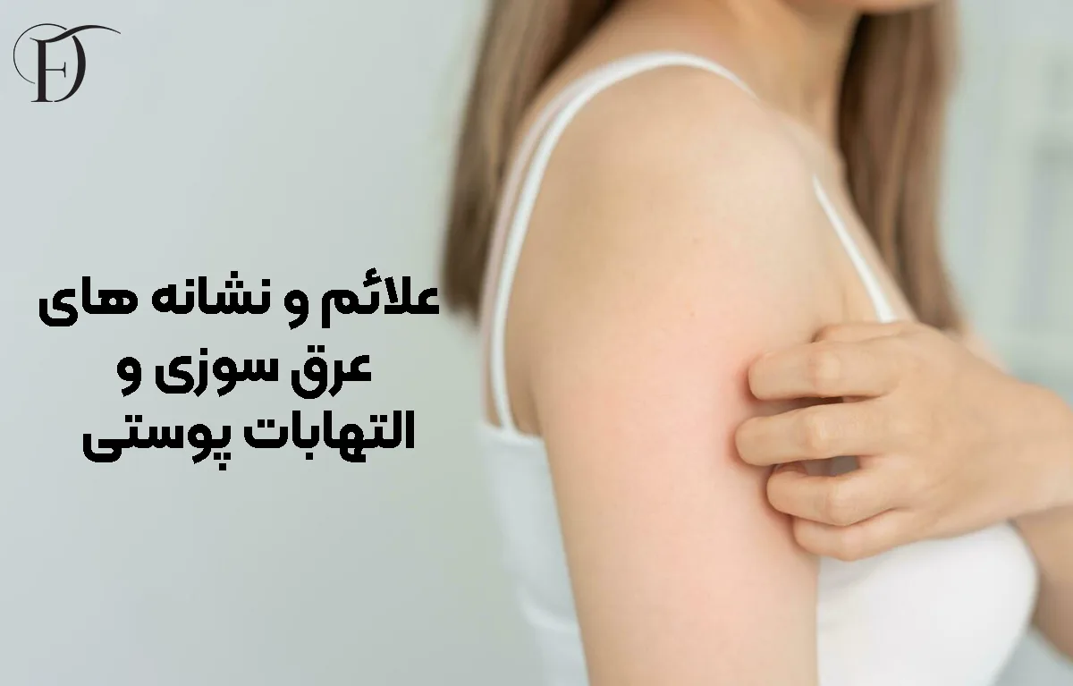 علائم و نشانه ‌های عرق ‌سوزی و التهابات پوستی